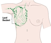 Koltuk Altı Lenf Bezi Büyümesi Belirtileri ve Tedavisi