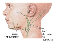 Lenf Bezlerinin Görevi Nedir?