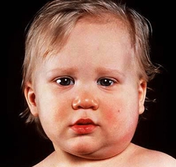 Bebeklerde Lenf Bezi Özellikleri ve Faydaları Nelerdir?